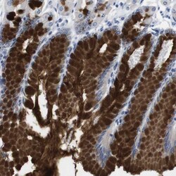 Complement Component C1rLP Antibody, Novus Biologicals 0.1mL; Unlabeled:Antibodies,