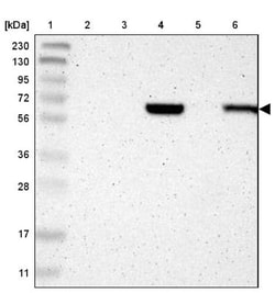 Complement Component C1rLP Antibody, Novus Biologicals 0.1mL; Unlabeled:Antibodies,
