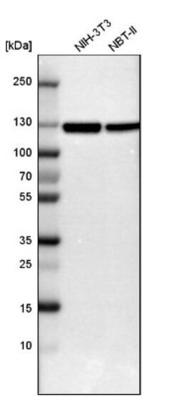 Complement Factor B Antibody, Novus Biologicals 0.1mL; Unlabeled:Antibodies,
