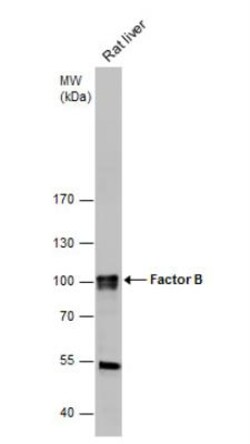 Complement Factor B Antibody, Novus Biologicals 0.1mL; Unlabeled:Antibodies,
