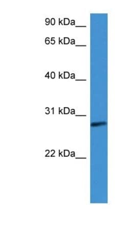 Complement Factor D/Adipsin Antibody, Novus Biologicals:Antibodies:Primary