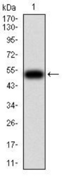 Complement Factor H-related 5/CFHR5 Antibody (3E1E10) - BSA Free, Novus