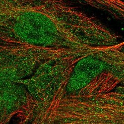 Complement Factor MASP3/MASP1 Antibody, Novus Biologicals 0.1mL; Unlabeled:Antibodies,