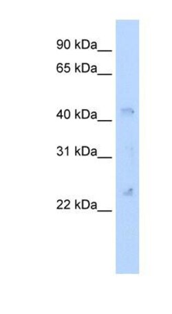 Connexin 37/GJA4 Antibody, Novus Biologicals 100 &mu;L | Buy Online | Novus Biologicals | Fisher Scientific