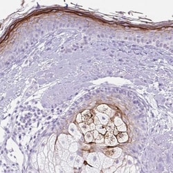 Corneodesmosin Antibody, Novus Biologicals:Antibodies:Primary Antibodies