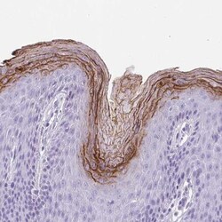 Corneodesmosin Antibody, Novus Biologicals:Antibodies:Primary Antibodies