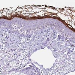 Corneodesmosin Antibody, Novus Biologicals:Antibodies:Primary Antibodies