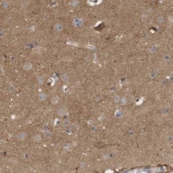 Coronin-2B Antibody, Novus Biologicals:Antibodies:Primary Antibodies