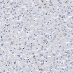 Coronin-2B Antibody, Novus Biologicals:Antibodies:Primary Antibodies
