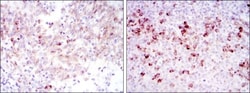 Cortactin Antibody (4C6), Novus Biologicals 0.1mL; Unlabeled:Antibodies,