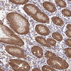 Cortactin Antibody, Novus Biologicals 0.1mL; Unlabeled:Antibodies, Polyclonal