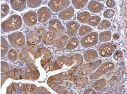 Cortactin Antibody, Novus Biologicals 0.1mL; Unlabeled:Antibodies, Polyclonal