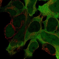 Creatine Kinase BB Antibody, Novus Biologicals:Antibodies:Primary Antibodies
