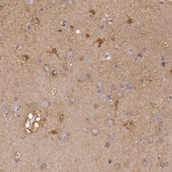 Creatine Kinase BB Antibody, Novus Biologicals:Antibodies:Primary Antibodies