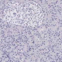 Creatine Kinase BB Antibody, Novus Biologicals:Antibodies:Primary Antibodies