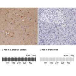 Creatine Kinase BB Antibody, Novus Biologicals:Antibodies:Primary Antibodies