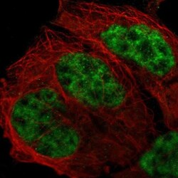 CrkRS Antibody, Novus Biologicals 0.1mL; Unlabeled:Antibodies, Polyclonal