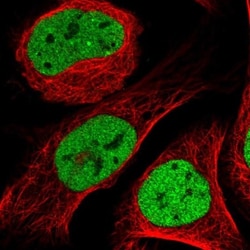 CtBP1 Antibody, Novus Biologicals 0.1mL; Unlabeled:Antibodies, Polyclonal