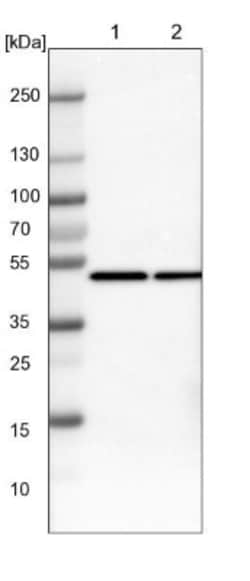 CtBP1 Antibody, Novus Biologicals 0.1mL; Unlabeled:Antibodies, Polyclonal