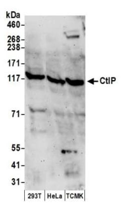 CtIP Antibody, Novus Biologicals 0.1mL; Unlabeled:Antibodies, Polyclonal