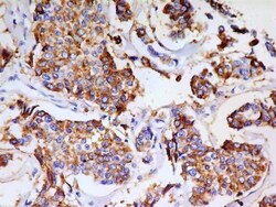 PSGL-1/CD162 Antibody (HECA-452), Novus Biologicals 0.025mL; Unlabeled:Antibodies,