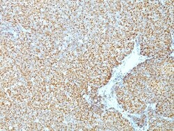 Cyclin D1 Antibody (CCND1/809), Novus Biologicals 0.2mg; Unlabeled:Antibodies,