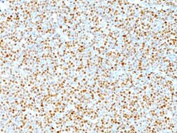 Cyclin D1 Antibody (DCS-6), Novus Biologicals 0.2mg; Unlabeled:Antibodies,