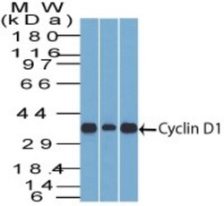Cyclin D1 Antibody (DCS-6), Novus Biologicals 0.2mg; Unlabeled:Antibodies,