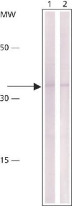 Cyclin D1 Antibody (DCS-6), Novus Biologicals 0.2mg; Unlabeled:Antibodies,