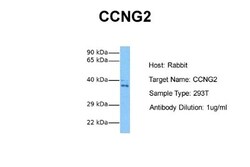 Cyclin G2 Antibody, Novus Biologicals 100 &mu;L | Buy Online | Novus Biologicals | Fisher Scientific