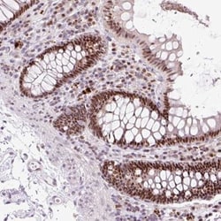 Cyclin L2 Antibody, Novus Biologicals:Antibodies:Primary Antibodies