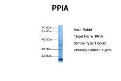Cyclophilin A Antibody, Novus Biologicals 0.1mg; Unlabeled:Antibodies,