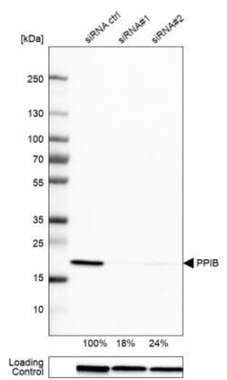 Cyclophilin B Antibody, Novus Biologicals 25 &mu;L; Unlabeled:Antibodies,