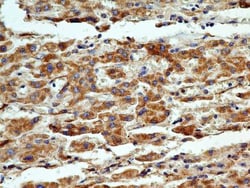 Cyr61/CCN1 Antibody (3A7.1B8) - BSA Free, Novus Biologicals 0.025mg; Unlabeled:Antibodies,