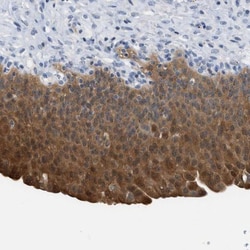 Cystatin B/Stefin B Antibody, Novus Biologicals 25 &mu;L; Unlabeled:Antibodies,