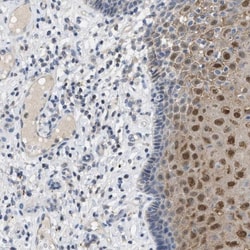 Cystatin B/Stefin B Antibody, Novus Biologicals 25 &mu;L; Unlabeled:Antibodies,