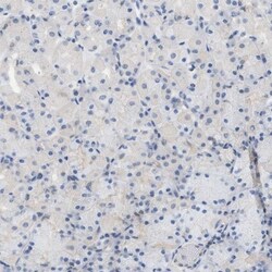 Cystatin B/Stefin B Antibody, Novus Biologicals 25 &mu;L; Unlabeled:Antibodies,