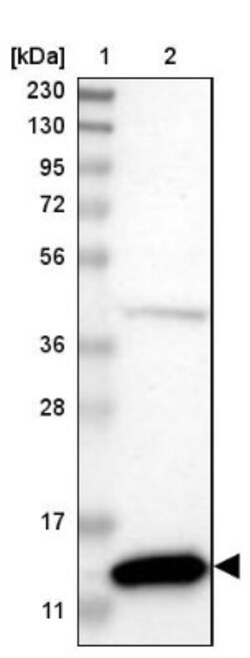 Cystatin B/Stefin B Antibody, Novus Biologicals 25 &mu;L; Unlabeled:Antibodies,