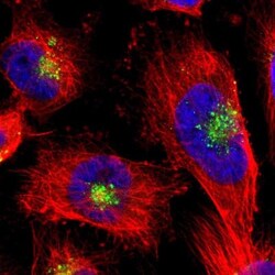 Cystatin C Antibody, Novus Biologicals 25 &mu;L; Unlabeled:Antibodies,