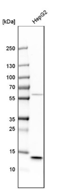 Cystatin C Antibody, Novus Biologicals 25 &mu;L; Unlabeled:Antibodies,