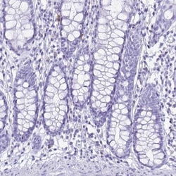 Cystatin D/Cst5 Antibody, Novus Biologicals 0.1mL; Unlabeled:Antibodies,
