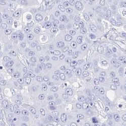 Cystatin E/M/CST6 Antibody, Novus Biologicals:Antibodies:Primary Antibodies