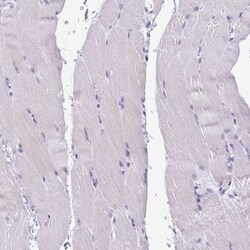Cystatin E/M/CST6 Antibody, Novus Biologicals:Antibodies:Primary Antibodies