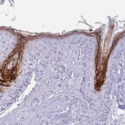 Cystatin E/M/CST6 Antibody, Novus Biologicals:Antibodies:Primary Antibodies