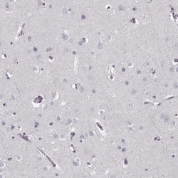 Cystatin F Antibody, Novus Biologicals:Antibodies:Primary Antibodies