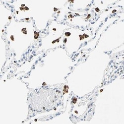 Cysteinyl Leukotriene R1/CysLTR1 Antibody, Novus Biologicals 0.1mL; Unlabeled:Antikörper