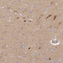 Cytochrome C Oxidase subunit 6c Antibody, Novus Biologicals 0.1mL; Unlabeled:Antibodies,