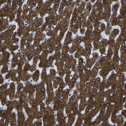 Cytochrome P450 2C8 Antibody, Novus Biologicals:Antibodies:Primary Antibodies