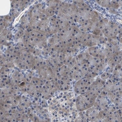 Cytochrome P450 2C8 Antibody, Novus Biologicals:Antibodies:Primary Antibodies