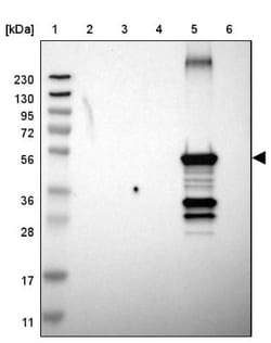 Cytochrome P450 2C8 Antibody, Novus Biologicals:Antibodies:Primary Antibodies